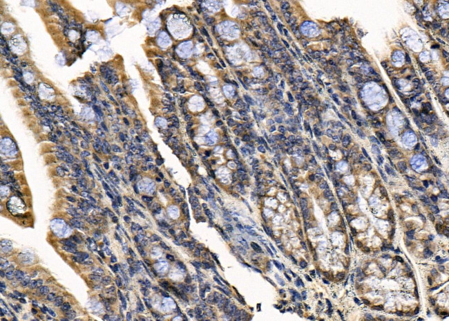 SSH1 Antibody in Immunohistochemistry (Paraffin) (IHC (P))