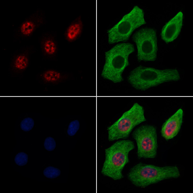 SMARCA1 Antibody in Immunocytochemistry (ICC/IF)