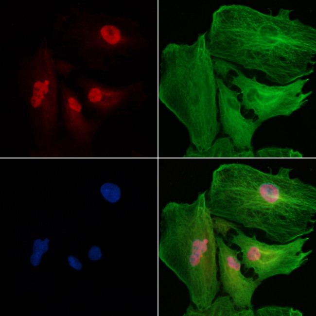 SMG1 Antibody in Immunocytochemistry (ICC/IF)