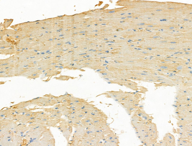 Smoothelin Antibody in Immunohistochemistry (Paraffin) (IHC (P))