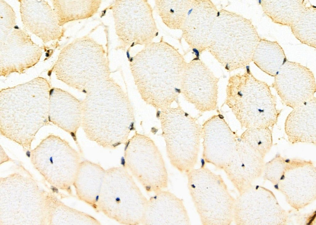 SMARCB1 Antibody in Immunohistochemistry (Paraffin) (IHC (P))