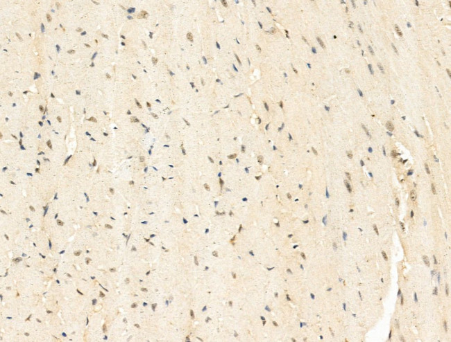 SNRNP200 Antibody in Immunohistochemistry (Paraffin) (IHC (P))