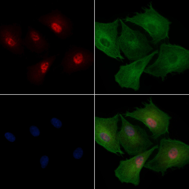 SNRPN Antibody in Immunocytochemistry (ICC/IF)