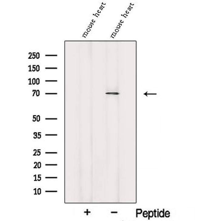 ARGBP2 Antibody in Western Blot (WB)