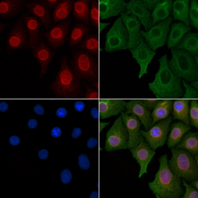 SOX7 Antibody in Immunocytochemistry (ICC/IF)