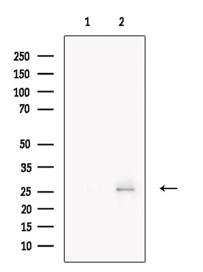 SPC25 Antibody in Western Blot (WB)