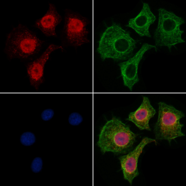 SPT6 Antibody in Immunocytochemistry (ICC/IF)