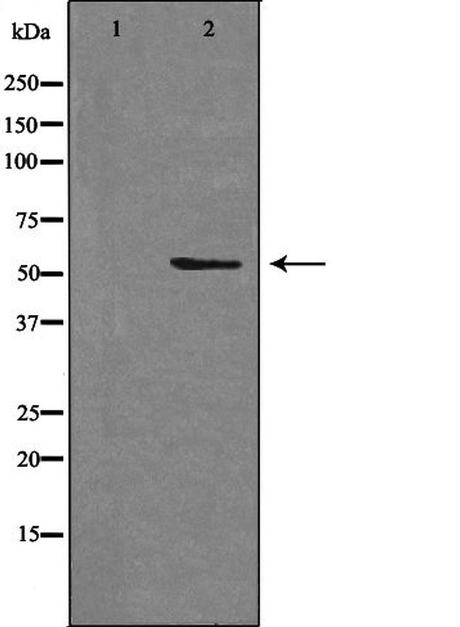 STEAP3 Antibody in Western Blot (WB)