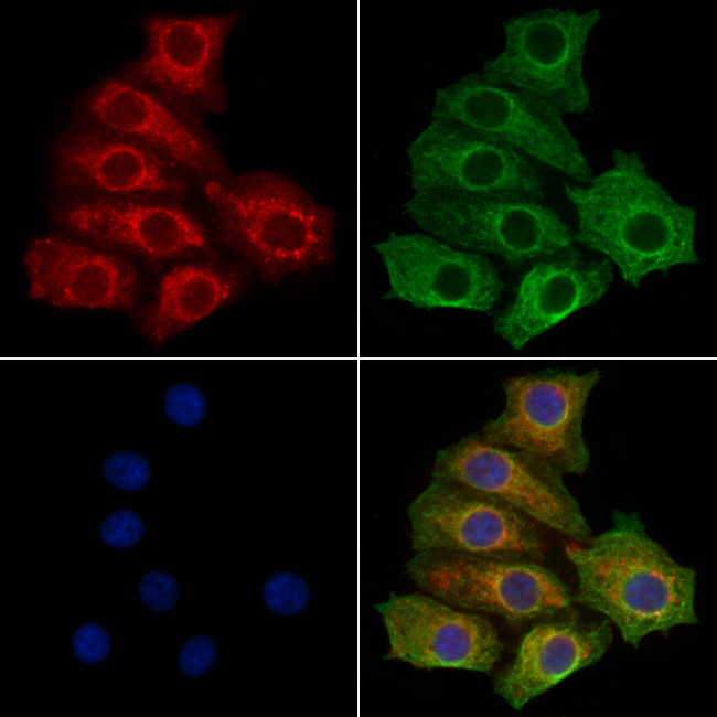STS Antibody in Immunocytochemistry (ICC/IF)