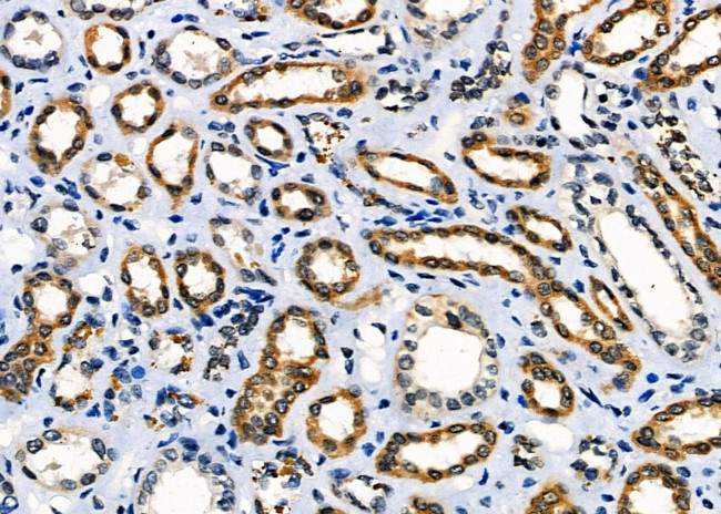 MST2 Antibody in Immunohistochemistry (Paraffin) (IHC (P))