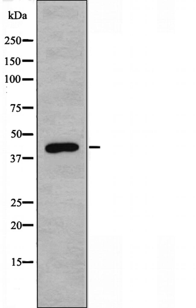 LYK5 Antibody in Western Blot (WB)