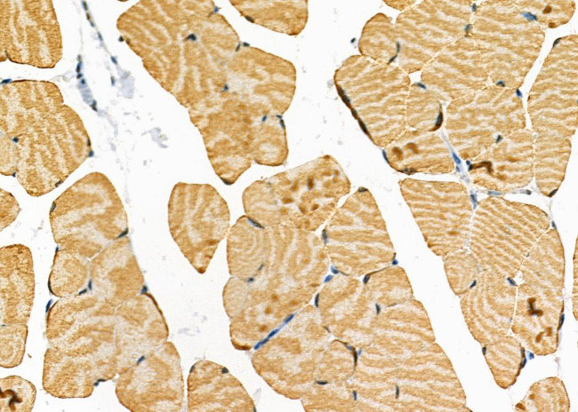 STRN4 Antibody in Immunohistochemistry (Paraffin) (IHC (P))