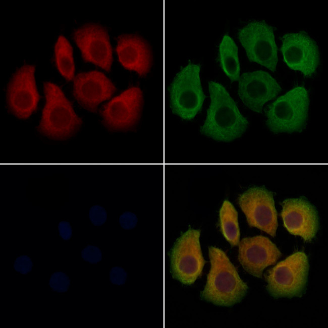 CCDC44 Antibody in Immunocytochemistry (ICC/IF)
