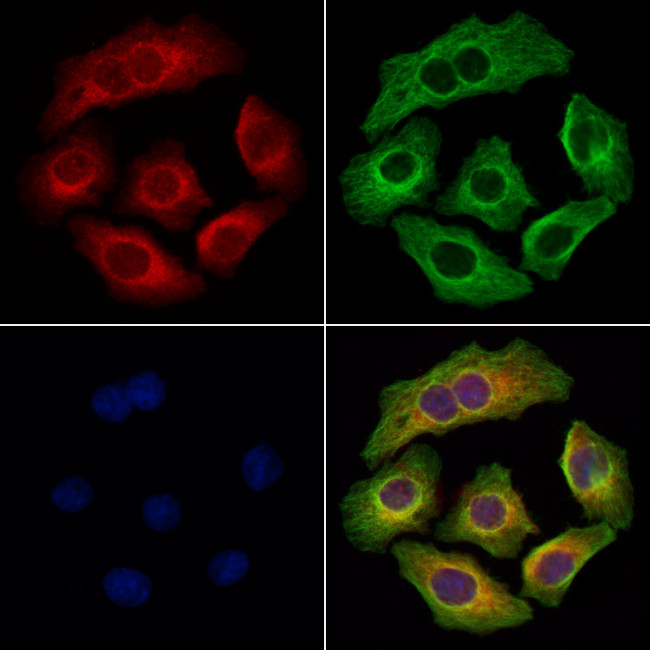 TCTEX1D2 Antibody in Immunocytochemistry (ICC/IF)