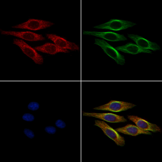 Tensin 1 Antibody in Immunocytochemistry (ICC/IF)