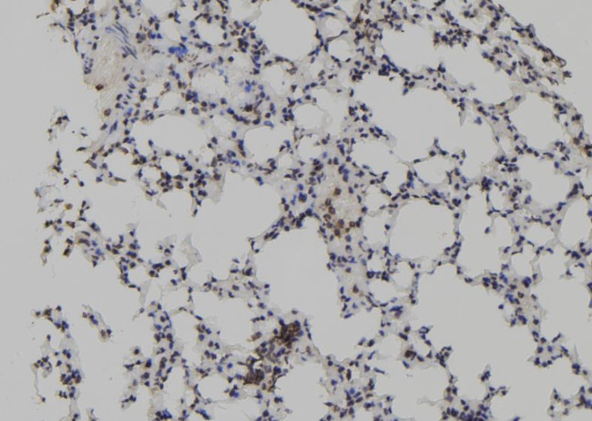 TET2 Antibody in Immunohistochemistry (Paraffin) (IHC (P))