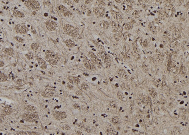 AP2 gamma Antibody in Immunohistochemistry (Paraffin) (IHC (P))