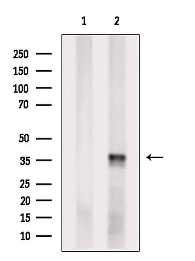 THAP11 Antibody in Western Blot (WB)