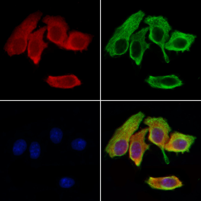 TMSB10 Antibody in Immunocytochemistry (ICC/IF)