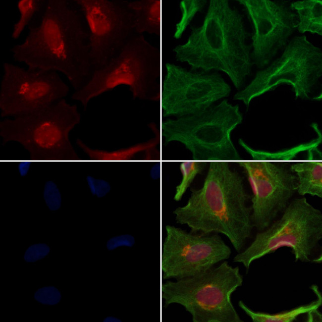 TIMM50 Antibody in Immunocytochemistry (ICC/IF)
