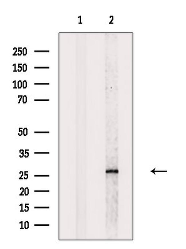 TMEM109 Antibody in Western Blot (WB)