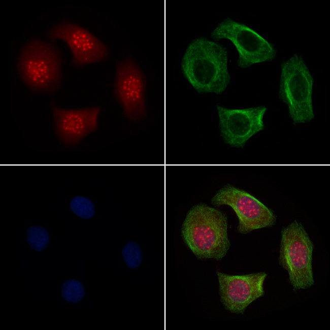 TMEM37 Antibody in Immunocytochemistry (ICC/IF)