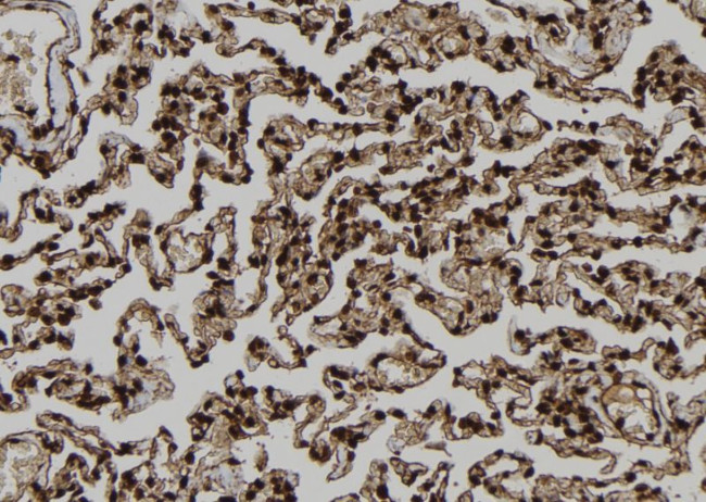 TP53I11 Antibody in Immunohistochemistry (Paraffin) (IHC (P))