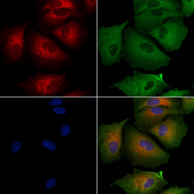 BERP Antibody in Immunocytochemistry (ICC/IF)