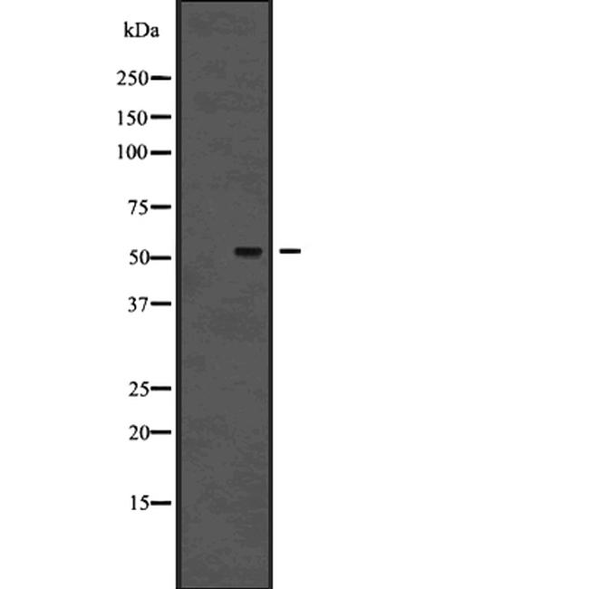 TRIM38 Antibody in Western Blot (WB)