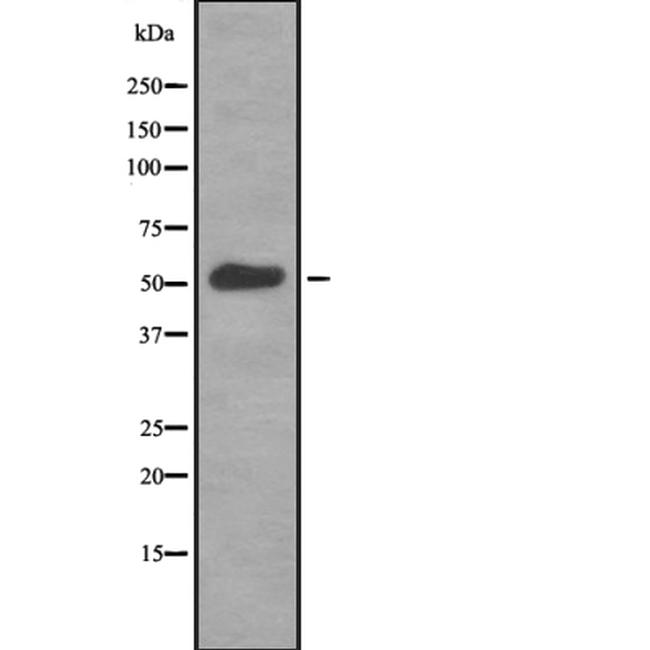 RNF36 Antibody in Western Blot (WB)