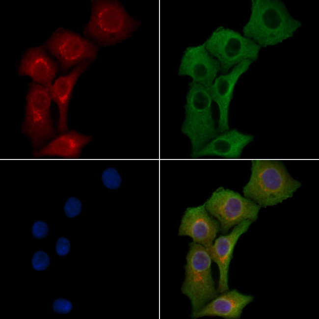 TRPC4 Antibody in Immunocytochemistry (ICC/IF)
