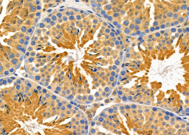 NPRL2 Antibody in Immunohistochemistry (Paraffin) (IHC (P))