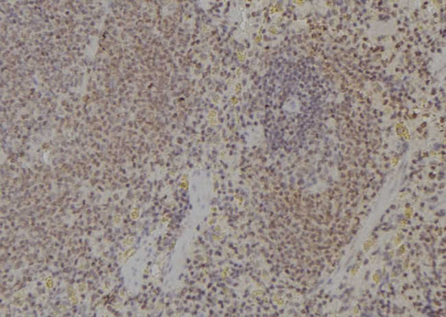 Ubiquitin Antibody in Immunohistochemistry (Paraffin) (IHC (P))