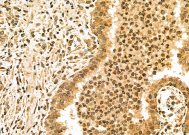 UHRF1 Antibody in Immunohistochemistry (Paraffin) (IHC (P))