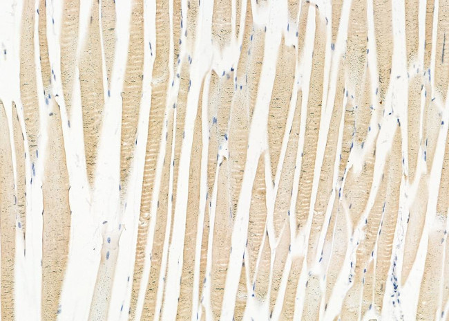 ULK2 Antibody in Immunohistochemistry (Paraffin) (IHC (P))