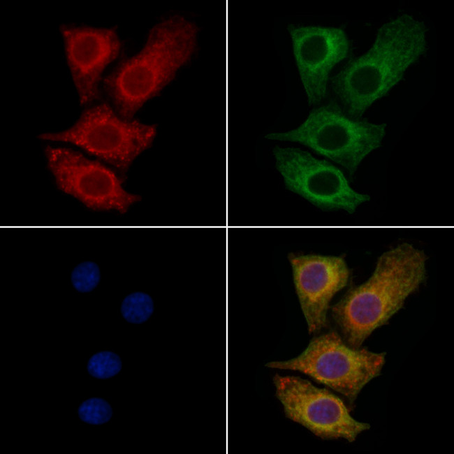 UMPS Antibody in Immunocytochemistry (ICC/IF)