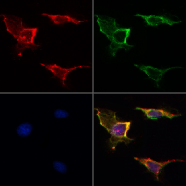 VDAC2 Antibody in Immunocytochemistry (ICC/IF)