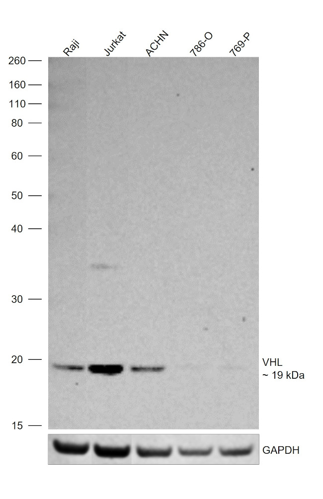 VHL Antibody in Western Blot (WB)