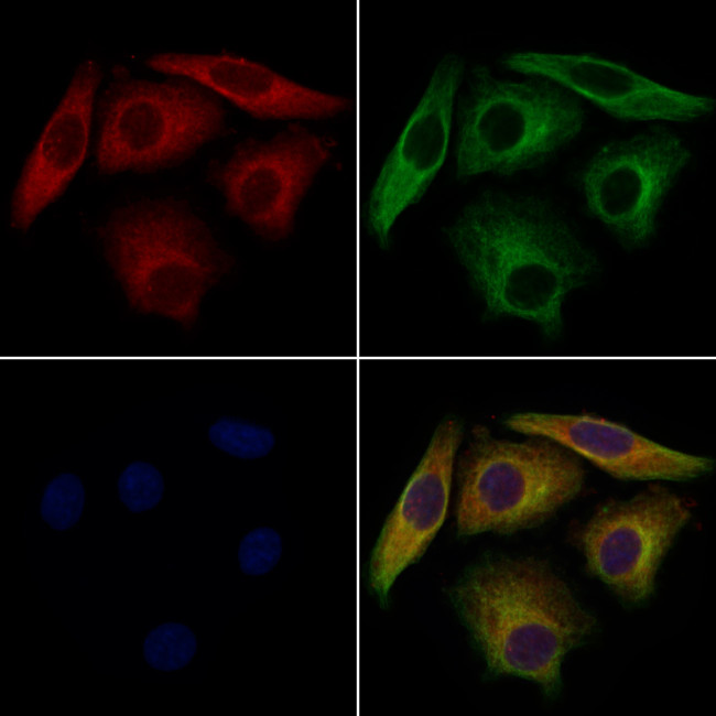 VPS29 Antibody in Immunocytochemistry (ICC/IF)