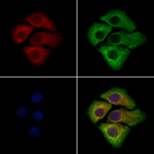 WISP2 Antibody in Immunocytochemistry (ICC/IF)