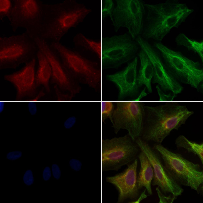 WNT5B Antibody in Immunocytochemistry (ICC/IF)