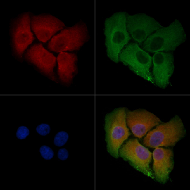 ZDHHC7 Antibody in Immunocytochemistry (ICC/IF)