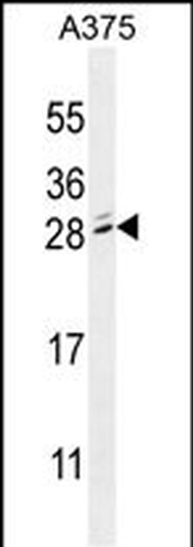 MBD3L2 Antibody in Western Blot (WB)