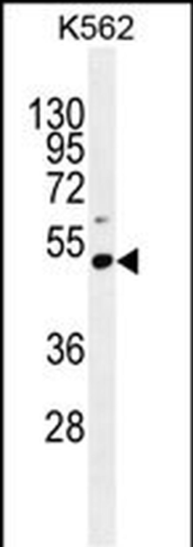 PRAMEF10 Antibody in Western Blot (WB)