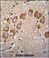 VSTM2B Antibody in Immunohistochemistry (Paraffin) (IHC (P))