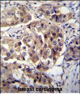 hCG 1995004 Antibody in Immunohistochemistry (Paraffin) (IHC (P))
