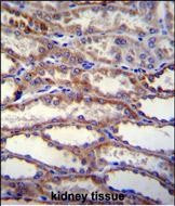 SHISA3 Antibody in Immunohistochemistry (Paraffin) (IHC (P))