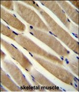 RNF90 Antibody in Immunohistochemistry (Paraffin) (IHC (P))