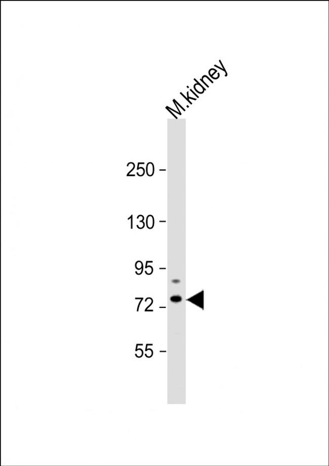 TIPARP Antibody in Western Blot (WB)