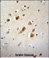 NIPSNAP3B Antibody in Immunohistochemistry (Paraffin) (IHC (P))